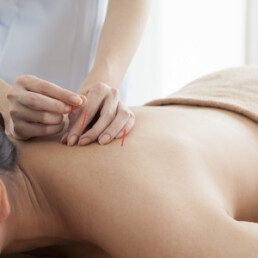 Pregnancy acupuncture Brisbane