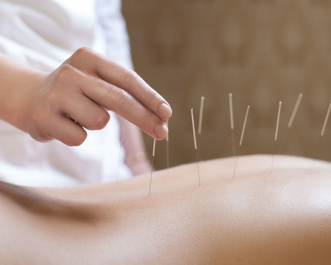 Chermside Acupuncture Clinic