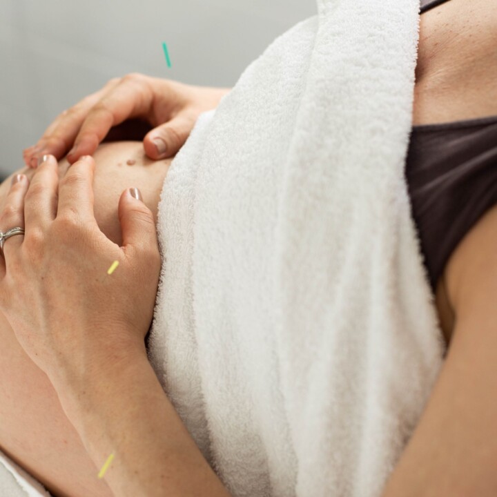 Pregnancy Acupuncture Brisbane